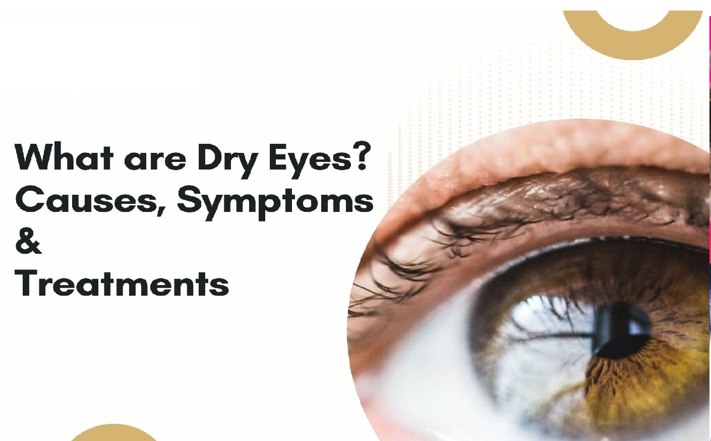 Read more about the article What is Dry eye syndrome, Causes, Symptoms and Treatment